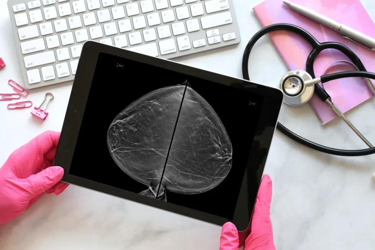 Nieuw onderzoek naar aanvullende scans bij dicht borstklierweefsel