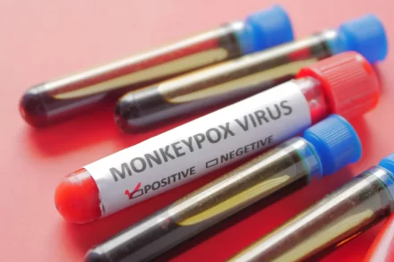 Eerste Mpox-variant vastgesteld in Frankrijk