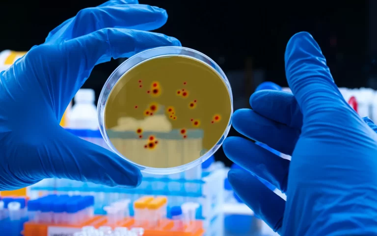 Acht doden in Tanzania door mogelijk Marburgvirus